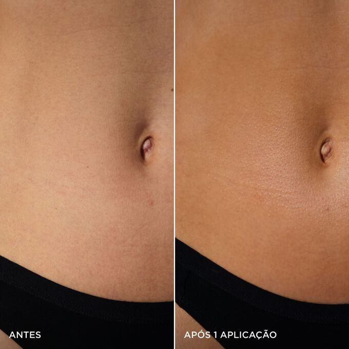 Imagens do antes e depois de uma barriga, luminosidade dourada natural com aplica&ccedil;&atilde;o de Clarins Gel&eacute;e Fra&icirc;che Auto-Bronzante.