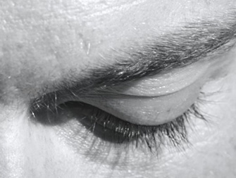 Como aplicar os cuidados para o contorno dos olhos?